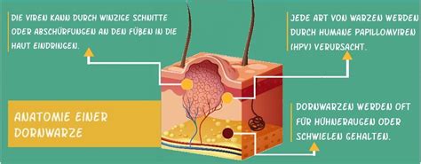 Dornwarze Bilder