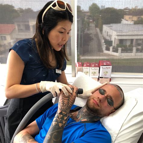 Dr Rand Tattoo Removal