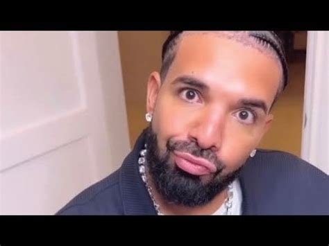 Radiant Royalty: Exploring the Phenomenon of Drake's Light Skin in Pop Culture