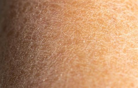 Deserted Delicacy: Conquering Dry Chapped Skin on the Intimate Area - A Guide for Men