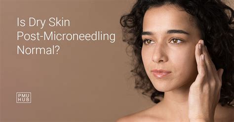 Unlock the Secret to Banishing Dry Skin After Microneedling with These Expert Tips