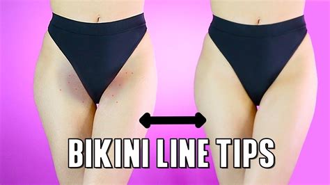 Luscious Legs in Distress: Conquering the Plight of Dry Skin on Bikini Line