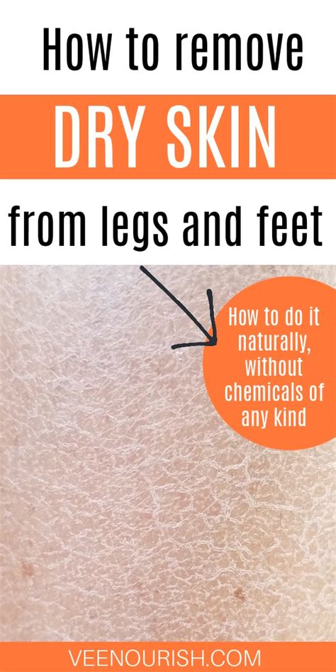 Say Goodbye to Flakey Feet: Dry Skin Removal Tips That Really Work