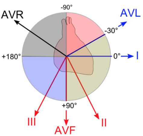 ECG