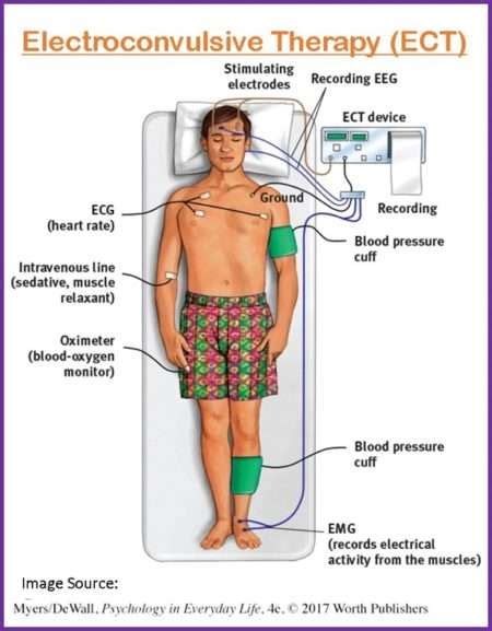 ECT Therapy Dallas Support