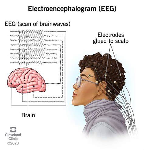 EEG: Detect Brain Issues Fast & Accurately.