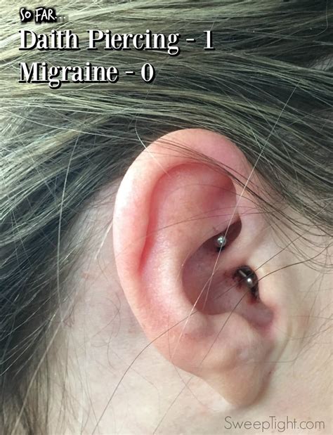 Ear Piercings Help With Migraines