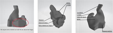 Earmold