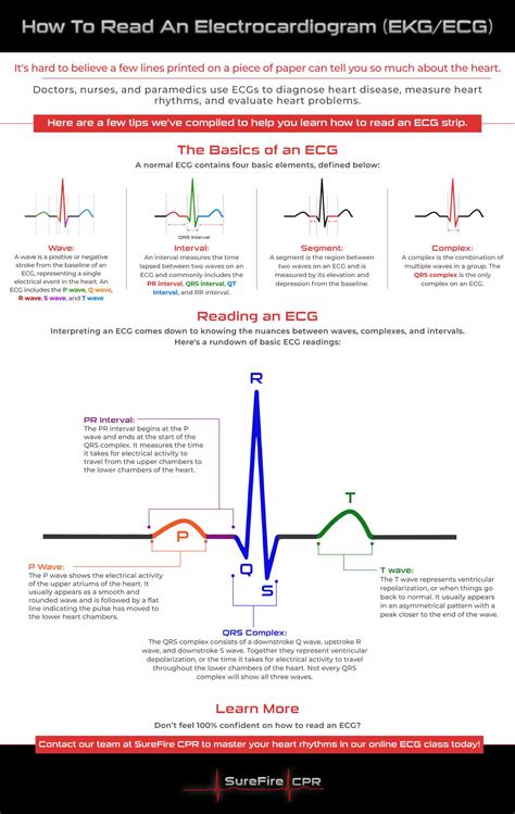 Ecg Interpretation Chart