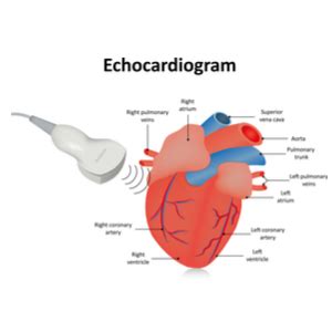 Echocardiogram Cost with Insurance