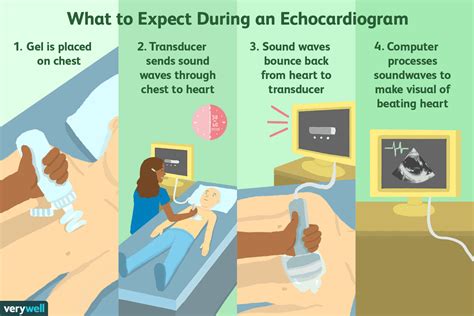 Echocardiogram Procedure What To Expect
