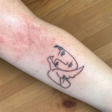 Can People With Eczema Get Tattoos