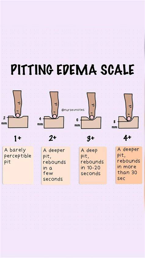 Edema Charting
