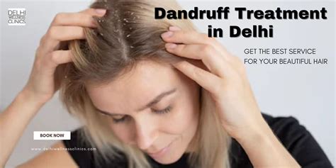 Effective Dandruff Treatment Options