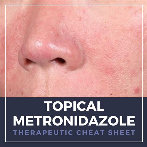 Effective Topical Treatments