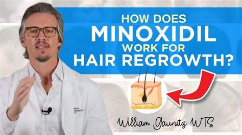 Effectiveness of Minoxidil