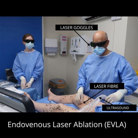 Elna Esthetic Laser