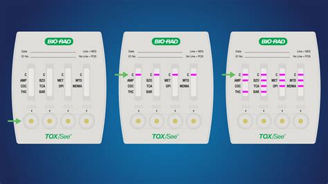 Emergency Toxicology Panel Test and interpretation