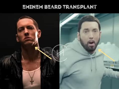 Eminem Facial Hair