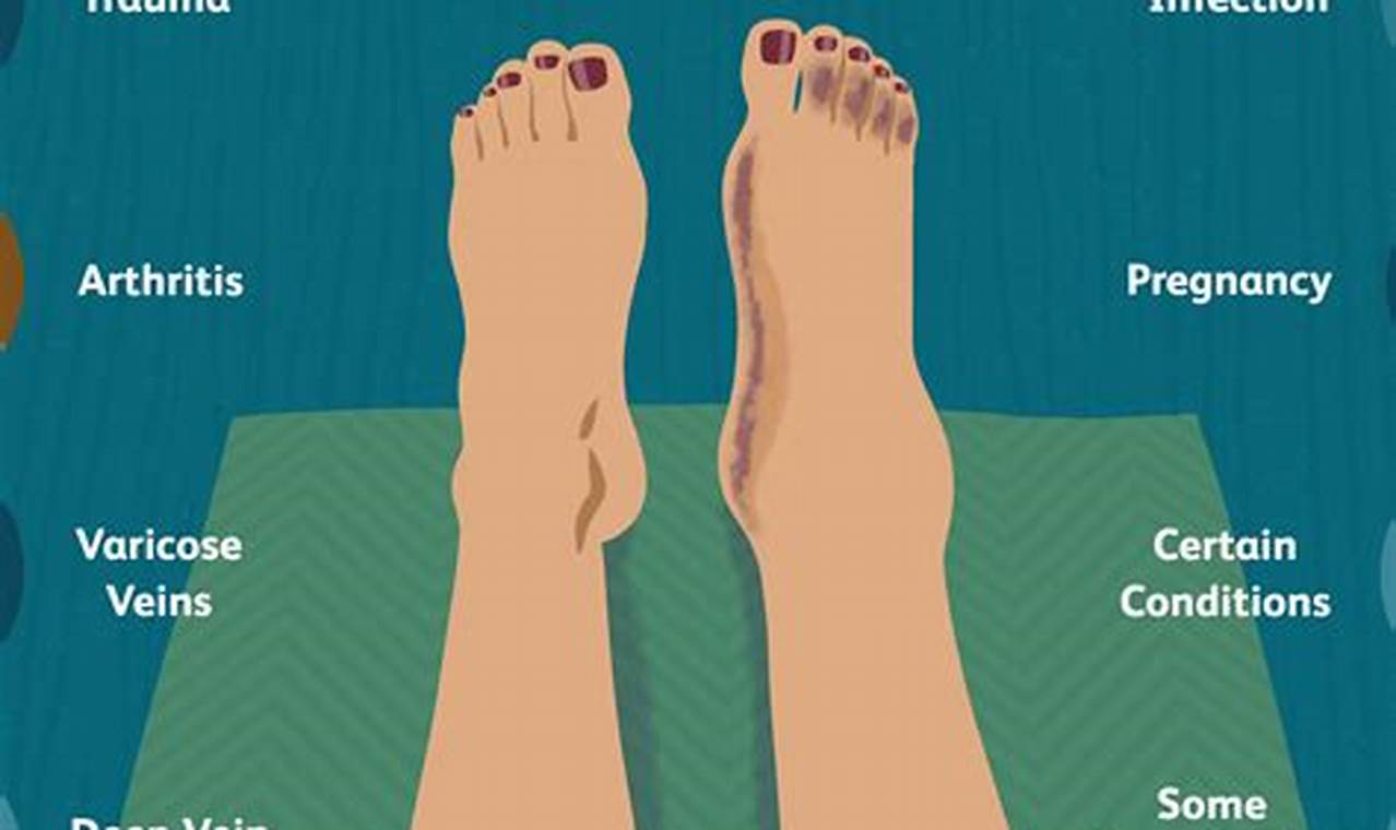 Emotional impact of swollen feet: Coping strategies