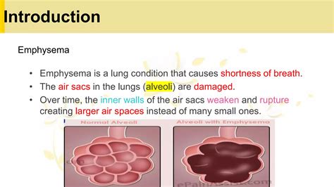 Subcutaneous Emphysema | RK.MD