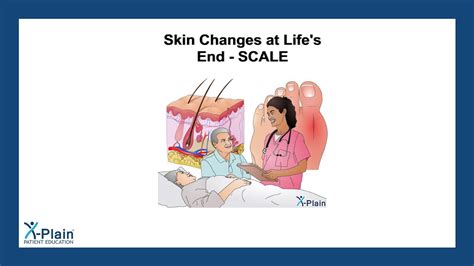 Understanding End-of-Life Skin Changes: A Guide for Caregivers