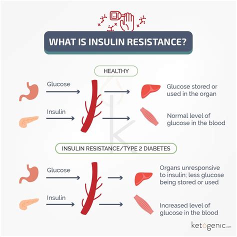 Enhancing Insulin Sensitivity
