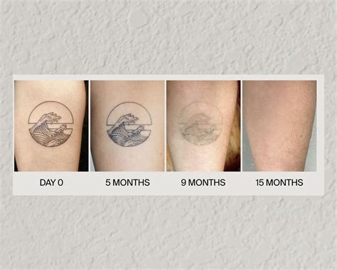Elevate Your Tattoo Experience with Ephemeral Ink: The Revolutionary Temporary Solution for Body Art
