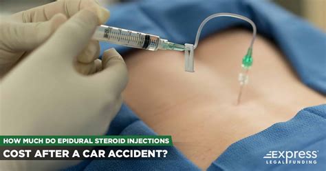 Epidural Steroid Injection Cost Without Insurance