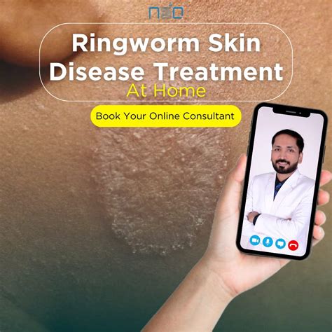 Erase Ringworm Scars: Fast, Effective Solutions.