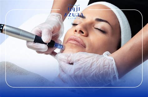 Erase Scars: Fast, Safe & Effective Solutions