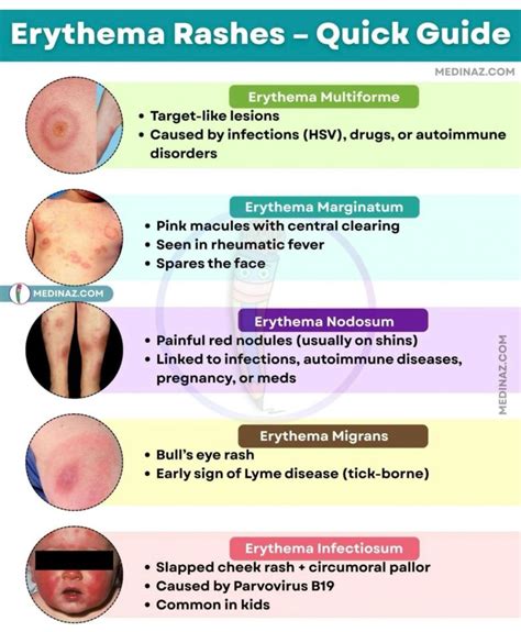 Erythema: Causes, Types & Effective Treatments