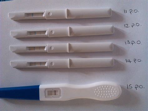 Test di gravidanza, le due linee Vita da Papà