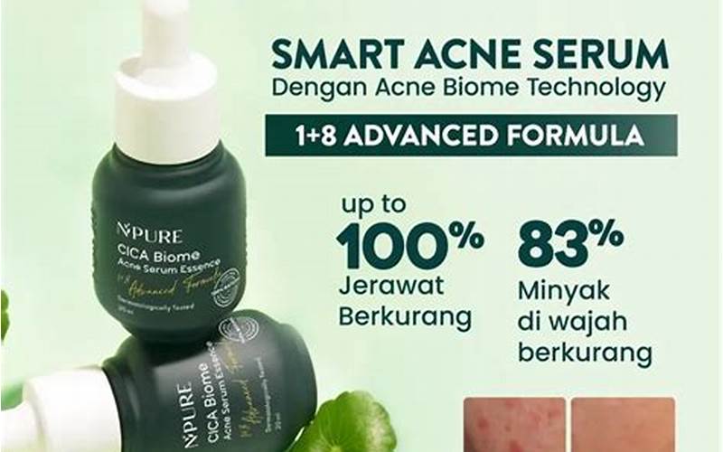 Essence Untuk Jerawat Dan Bekasnya