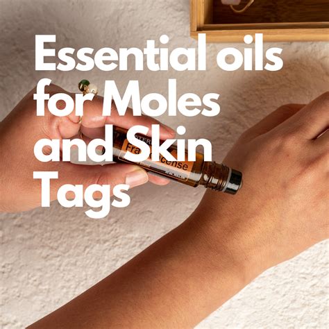 Unlock Flawless Skin: Discover the Magic of Essential Oils for Skin Tags and Moles