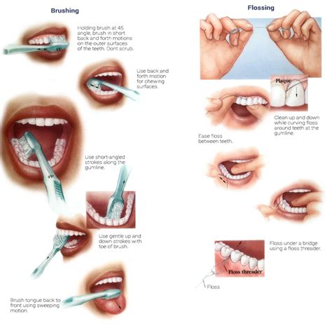 Essential Oral Hygiene Techniques