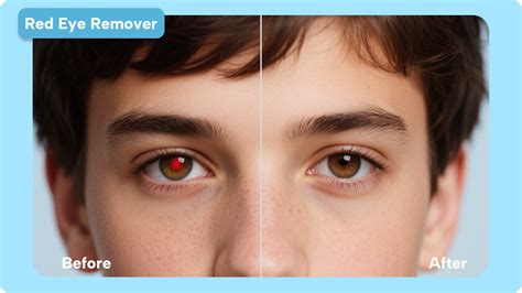 Essential Tips for Using Apps To Get Rid Of Red Eye