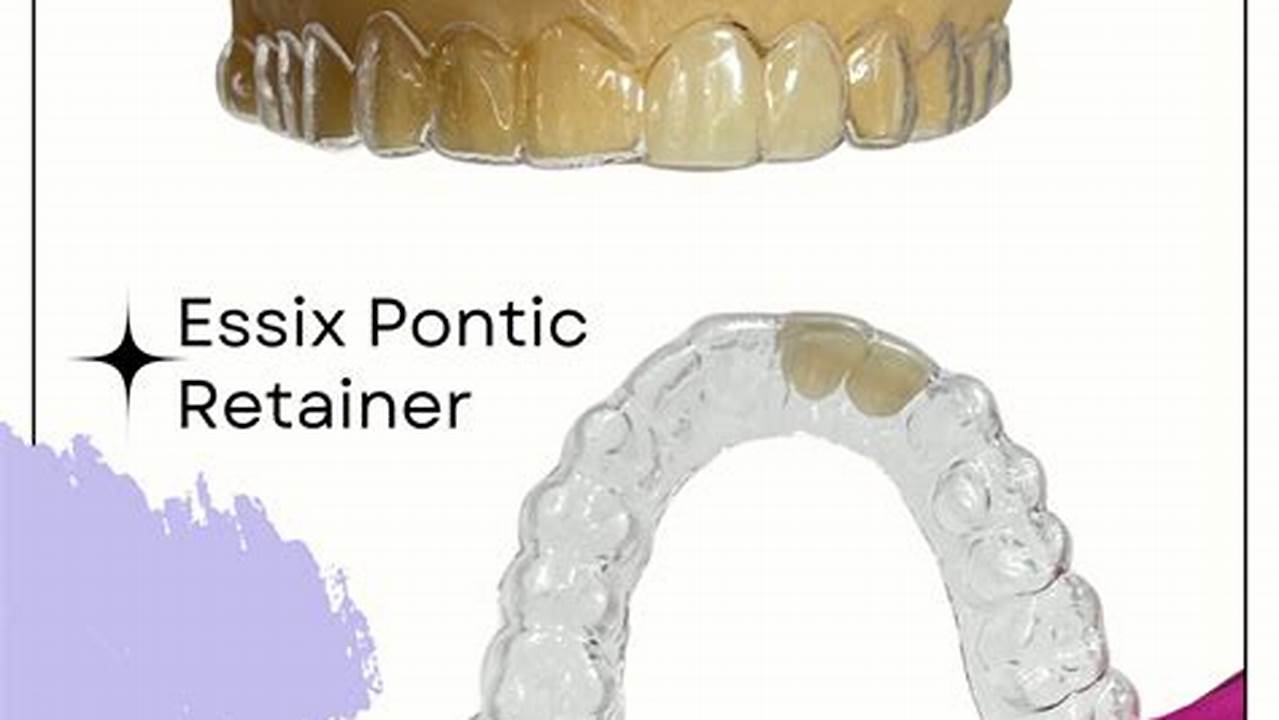 Essix Retainer Ada Code 2024