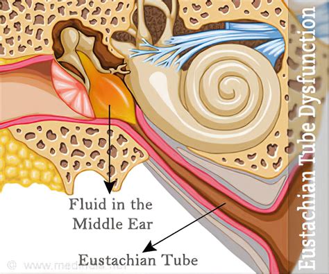 Eustachian Tube: Function, Problems & Solutions