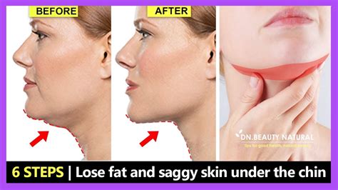10 Effective Ways to Say Goodbye to that Annoying Double Chin and Excess Skin under your Jawline!