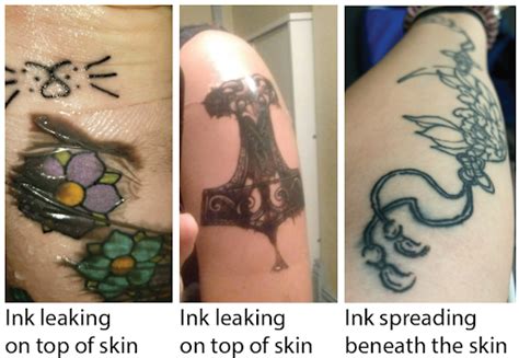 Stained Skin No More: How to Deal with Excess Tattoo Ink Residue