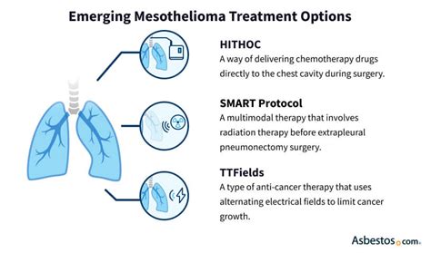 Exploring Mesothelioma Treatment Options