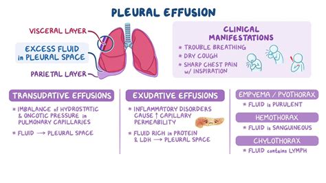 Exploring Pleural Effusions