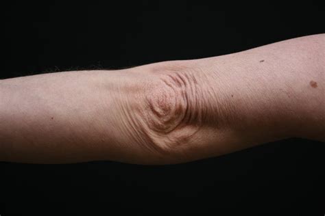 Flawless Elbows - Say Goodbye to Extra Skin with These Expert Tips!