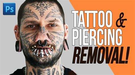 Can’t stop watching this extreme tattoo removal from