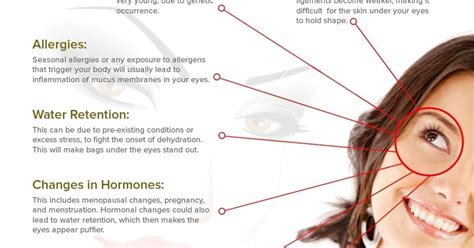 Eye Bags: Causes & Effective Solutions