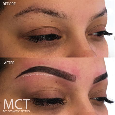 Eyebrow Tattooing Before And After 3 YEARS AFTER