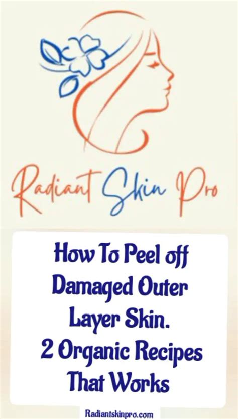 Peel Away Those Damaged Outer Layers of Skin