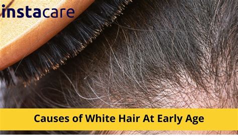 Frequently Asked Questions About Early White Hair