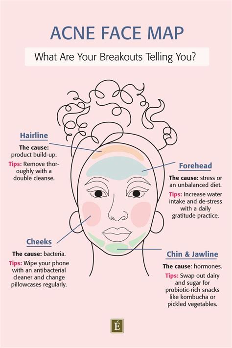 Face Chart For Breakouts